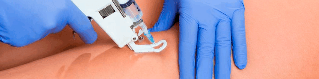Mesoterapia Estética, Esp.
