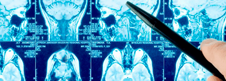 Técnico Profesional en Neuroeducación